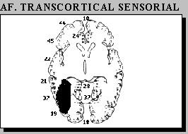 Afasia transcortical sensorial Anomia. Fluida.