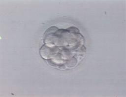 células Día +3 Embrión 6-8 células Día