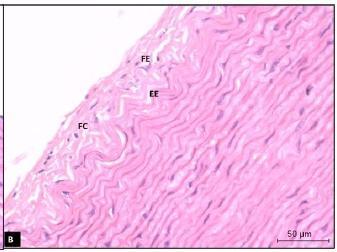 Arteria de gran calibre o Elástica o Conductora Túnica Media Predominio de fibras elásticas conformando membranas, en este corte se observa la membrana limitante elástica