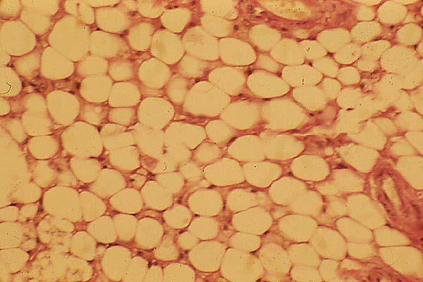 Al microscopio de luz cada célula aparece como un pequeño anillo de citoplasma rodeando una
