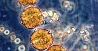 SINDROMES TÓXICOS CAUSADAS POR MICROALGAS Veneno o toxina paralizante de moluscos (PSP) Síntomas: parálisis de los miembros inferiores y superiores, perdida de la