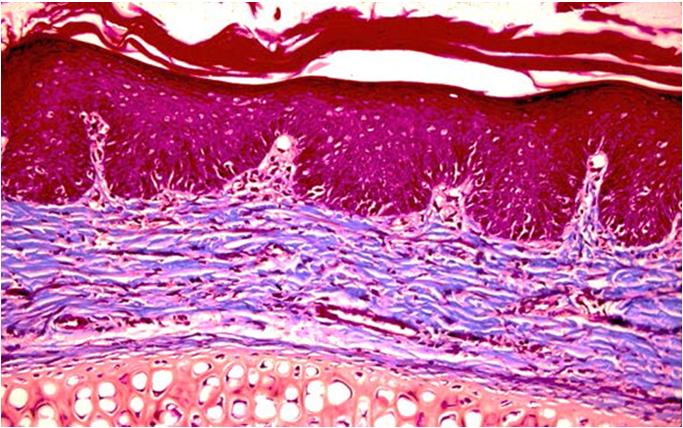 célula de Langerhans (L). Piel delgada del dorso. La línea limitante dermoepidérmica muestra una ondulación poco notoria.