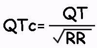 Cálculo del Intervalo QT El intervalo QT representa la sístole eléctrica ventricular o, lo que es lo mismo, el conjunto de la despolarización y la repolarización ventricular.