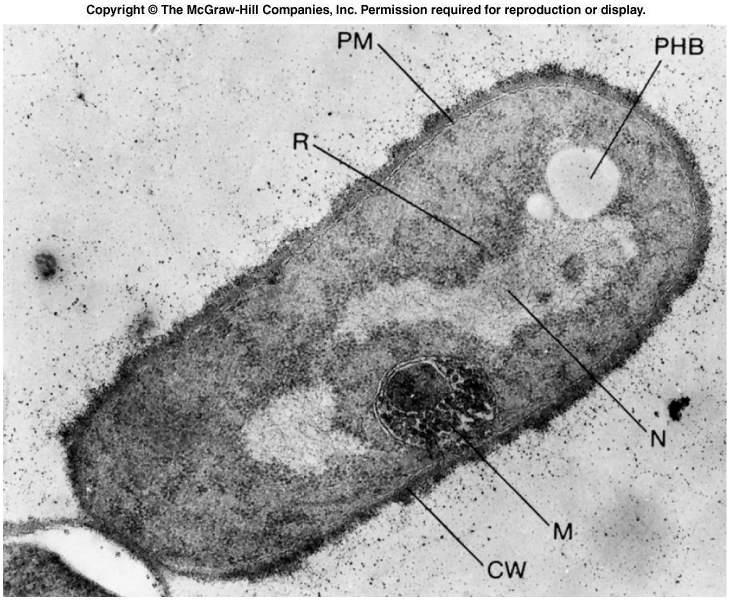Características estructurales del dominio bacteria DP/PAU - Membrana plasmática: Al igual que la de células eucariotas, está formada por una bicapa lipídica, pero a diferencia de las eucariotas,