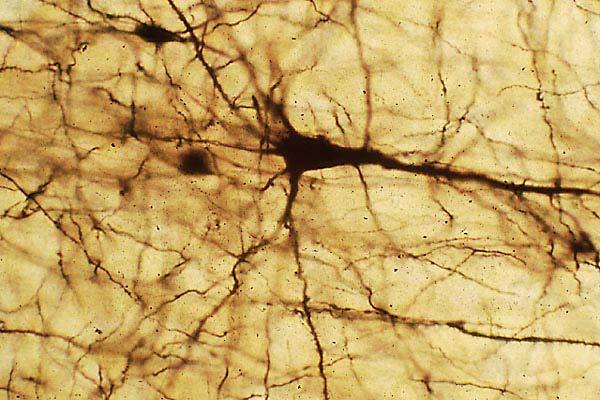 TEJIDO NERVIOSO El tejido nervioso consiste en células nerviosas llamadas neuronas y algunas células de