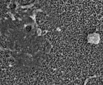 células analizadas morfométricamente en este grupo de córneas presentan una membrana celular intacta.