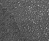 A la derecha una célula cuyas microproyecciones tienen un tono de gris desigual con punteados blancos (C) y otra con tonos más uniformes (D).