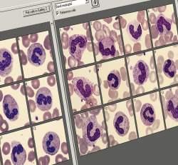 Revolucionando la hematología Con automatización escalable y procesamiento de frotis de sangre El analizador integrado de imágenes celulares Sysmex DI-60 proporciona automatización completa al