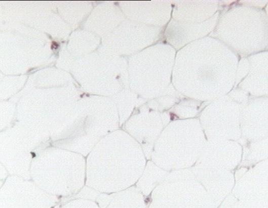 a) El tejido conjuntivo El tejido conjuntivo presenta los siguientes tipos de células fundamentales: - Fibrocitos o formadores de fibras, son las células más abundantes.