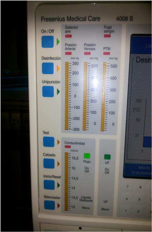 Botonera: zona de la máquina de diálisis correspondiente al monitor donde se dispone de un