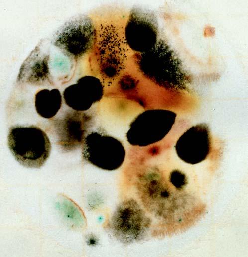La Placa Petrifilm MR para Recuento de Mohos y Levaduras (Yeast & Molds YM) es un sistema de medio de cultivo listo para ser empleado, contiene nutrientes de Sabhi, dos antibióticos, indicador de