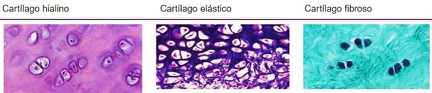 Tipos de Cartílago El cartílago hialino contiene colágena tipo II en su matriz; es el cartílago más abundante del organismo y tiene muchas funciones.