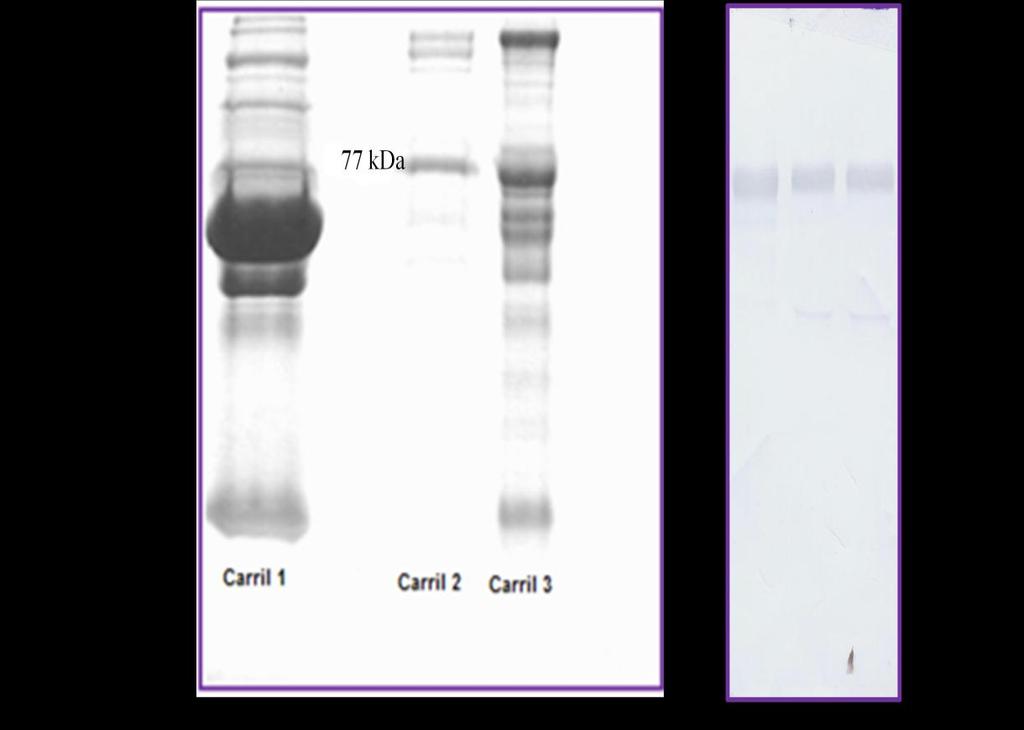 Figura 16. SDS-PAGE e Inmunodetección de la IgM. a) Comparación de las fracciones cromatográficas de elución obtenidas mediante dos esquemas cromatográficos.