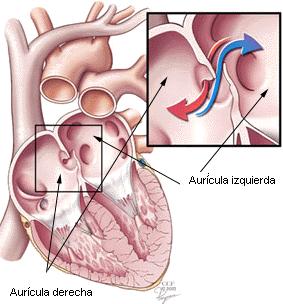 Las cavidades situadas en la parte superior se denominan aurículas, y las dispuestas en la parte inferior, ventrículos.