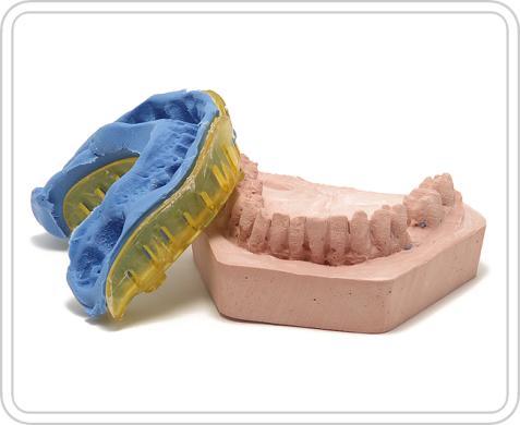 la bio-réplica Perdentex donde se desee colocar el implante (aliviar con cera la zona retentiva de los dientes afectados por