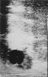Figura 2b. Ultrasonografía mostrando el desarrollo de un folículo dominante maduro de 1.8 cm de diámetro. - Para ver esta imagen en su tamaño completo, diríjase al sitio www.ivis.org.