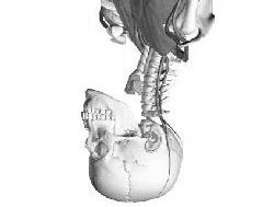 FUNCION 1) ESTATICA : De control de la cabeza. Depende en buena parte del buen funcionamiento de los órganos de los sentidos.