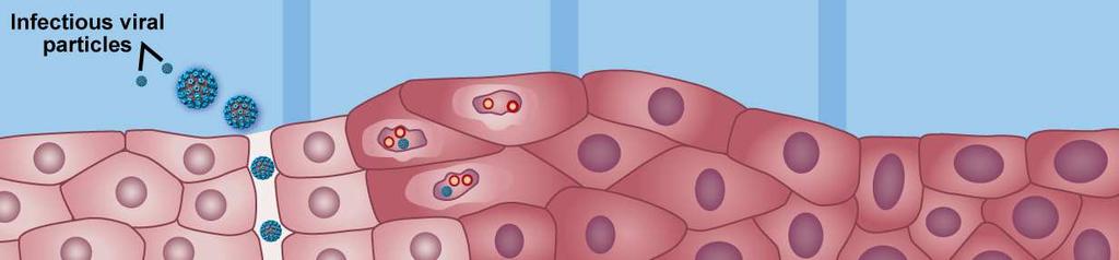 Los cánceres relacionados con el VPH se desarrollan de una forma similar Desarrollo de la enfermedad 1,5, * Infección inicial Infección persistente