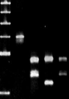 Resultados de la genotipage en la clínica Caso Clínico-Genotipage Análisis molecular complementar: DO*A/DO*A Análisis serológica
