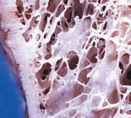 osteogénico y fibroso Superficies internas (trabéculas y