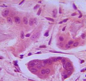 Tejido óseo- Células OSTEOCLASTOS Multinucleados Lisosomas Borde fruncido (Libera enzimas anhidrasa carbónica e