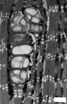 Anatomía del xilema...de Pouteria 441 a b Fig. 6. Pouteria eugeniifolia. a. Poros múltiples radiales, con esclerotílides. b. Radios de 1-2 células de ancho; vaso con esclerotílides.