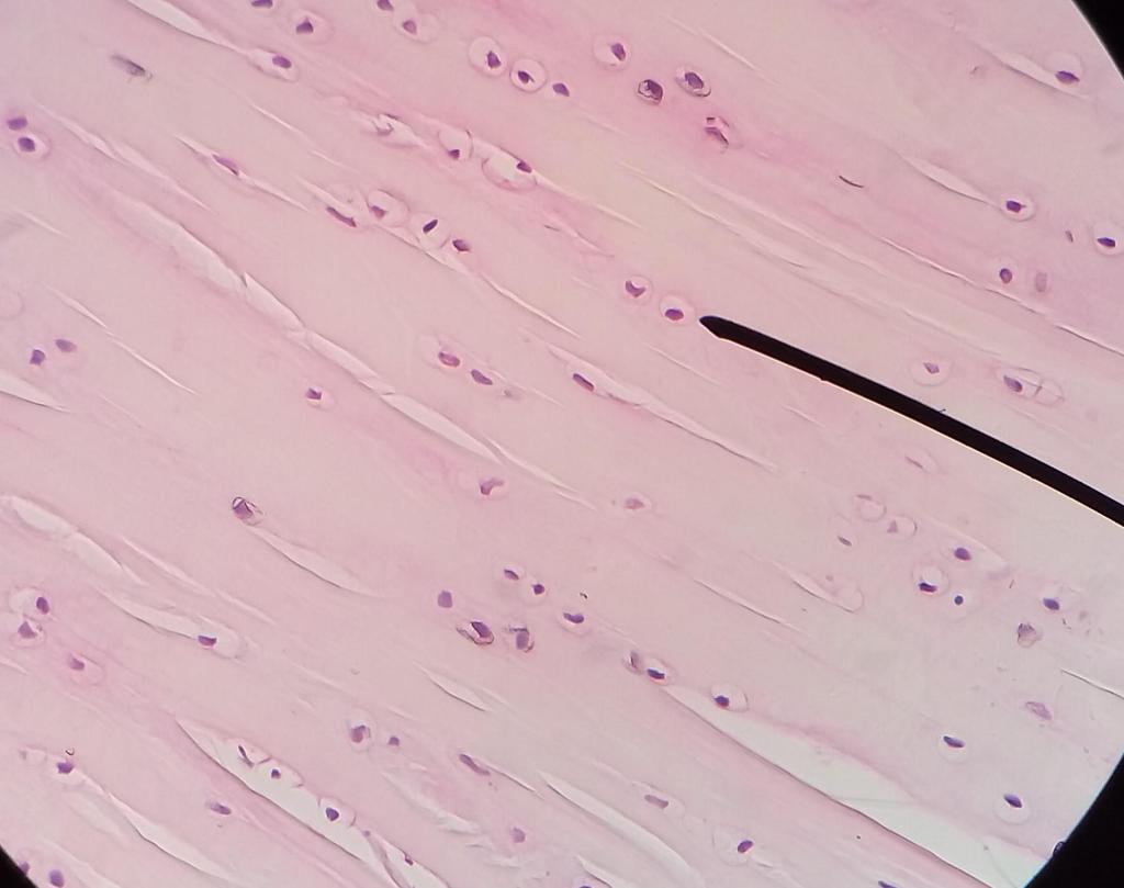 Fuente: Propia En la imagen (correspondiente a cartílago fibroso, 400x), se pueden apreciar los condrocitos (uno de ellos señalado con el indicador) en su laguna