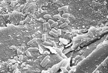 Crean un ambiente localizado de ph bajo que ayuda a la colonización de las partículas del excipiente mediante las bacterias tolerantes al ácido, particularmente las especies de lactobacilos.