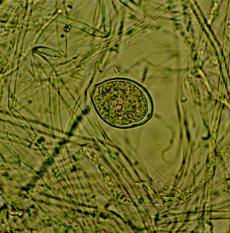 COMPENDIOS DE HORTICULTURA Esporangio de Phytophthora capsici Esporangio de Phytophthora parasitica cuando en algún momento se introduzca un fitopatógeno de los descritos, éste podrá colonizar