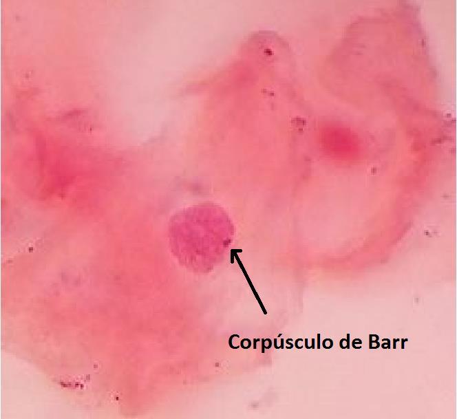 Qué tipo de heterocromatina es el Corpúsculo de Barr?. En qué fase de la mitosis se observa la cromatina sexual?