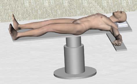 Paciente en decúbito dorsal en cama operatoria radiotransparente con la rodilla que se debe tratar extendida.