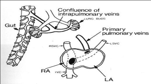 Embriología En etapas precoces: Venas pulmonares primarias se encuentran conectadas a venas de la circulación sistémica.