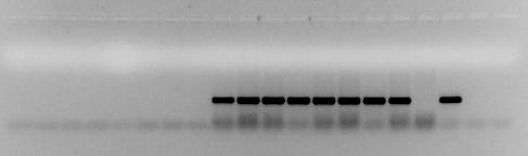 PCR MK para la detección n de los genes stx1 1 y stx2 Cepa E.