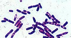 tuberculosis 1881: Estudio las esporas y las diferenció de los bacilos.