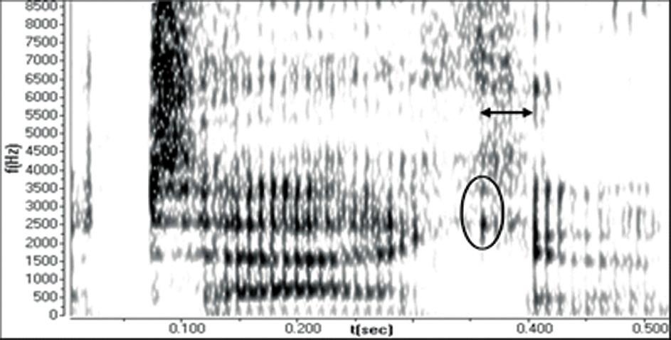 We can also see that for the sequence /xi/, one noise focus is shifting downwards and it is situated between approximately 2,000 and 6,500 Hz, whereas the other noise focus starts at about 9,000 Hz