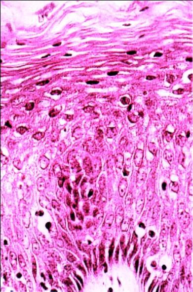 Tejidos animales: epitelios EPITELIOS DE REVESTIMIENTO Función Sus células CLASIFICACIÓN Recubren tanto la parte