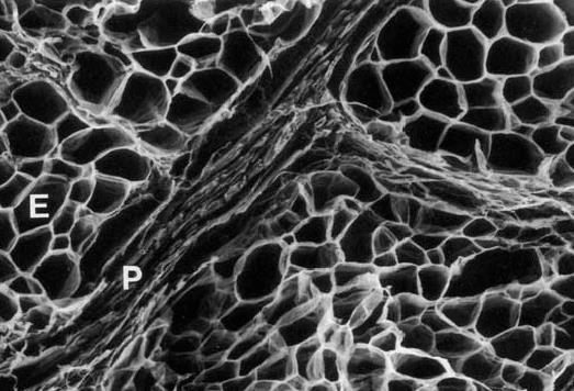 conjuntivo Endomisio: rodea células