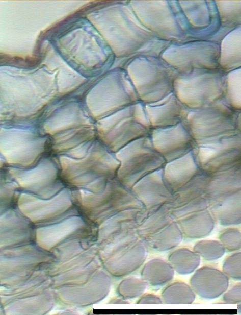 2 epidermis peridermis súber felógeno felodermis colénquima (corteza primaria) Esta imagen nos muestra una epidermis unistrata cuyas células alternan con esclereidas.