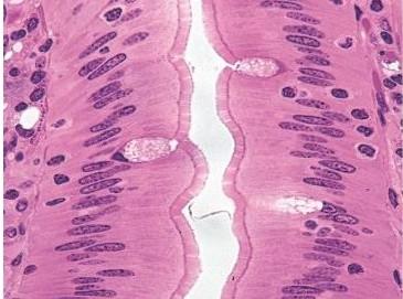 (epitelio superficial) oviducto Útero Puede presentar células