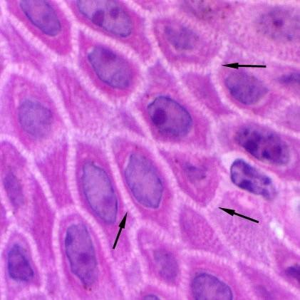 TEJIDO EPITELIAL-Características generales Derivan de las tres hojas embrionarias Células agrupadas con escasa o nula