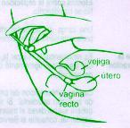 El tratamiento debe haber finalizado antes del inicio de la menstruación. INSTRUCCIONES DE USO DEL APLICADOR 1.