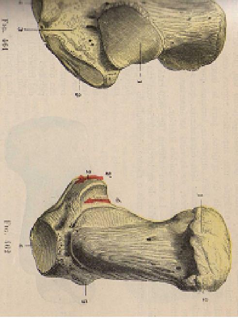 CALCANEO-caras superior e inferior 1.Carilla articular posteroexterna 2.Carilla articular anterointerna 3.Canal del tarso 4.Carilla articular anterior 5.