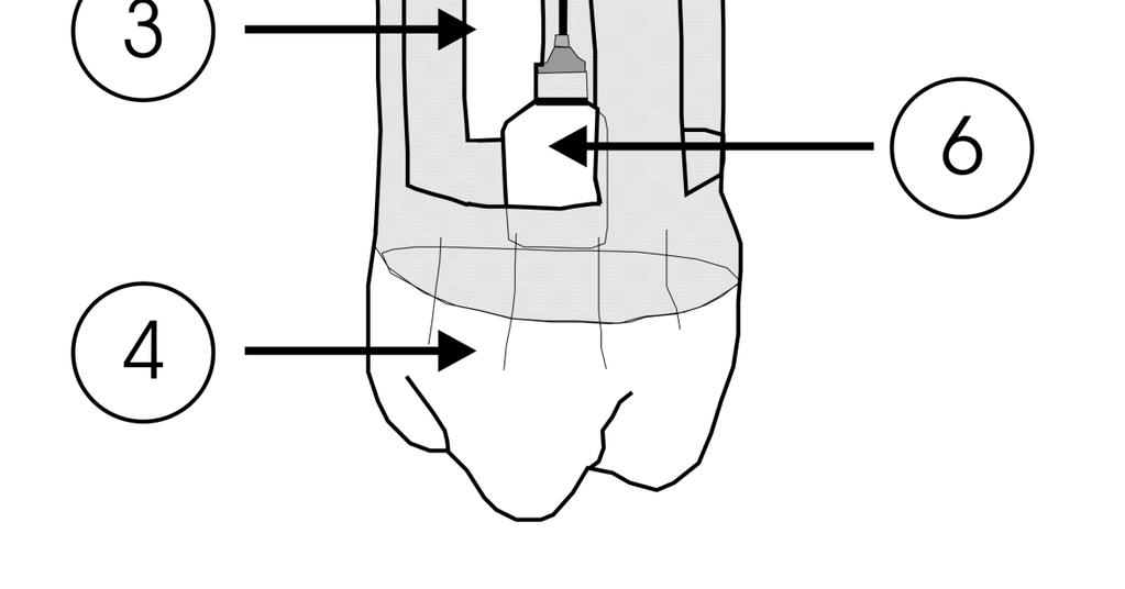 información sobre la facilidad o dificultad de hechura. a b Fig. 1. a, ECOIAPAR (una ventana); b, ETOTRAP (tres ventanas). 1. Alambre para colgar la trampa; 2. Envase de PET (2.0 litros); 3.