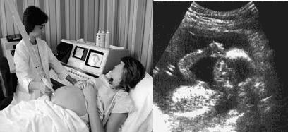 Anexo 2 ULTRASONIDOS En muchos países se pueden tomar imágenes del feto (bebé en desarrollo en el vientre de su madre) utilizando imágenes tomadas por ultrasonidos (ecografía).