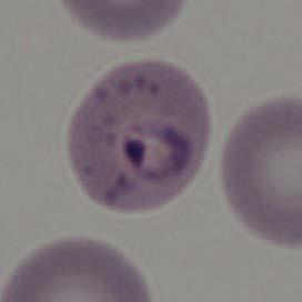 Características del plasmodio y del eritrocito parasitado (Fig. 5.6) a) Célula hospedadora Aspecto (dimensión y forma): no hay modificación ni en dimensiones ni en tamaño.