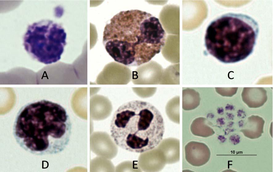 ++ Figura 3. Diferentes elementos sanguíneos (A) basófilo, (B) eosinófilo, (C) linfocito, (D) monocito, (E) neutrófilo y (F) plaquetas (flechas).