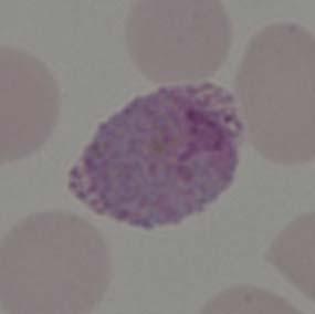 d) Gametocitos Macrogametocito: grande, redondeado u oval. Núcleo compacto y excéntrico. Citoplasma homogéneo. Con pigmento fino de color pardo claro difundido por todo el citoplasma.