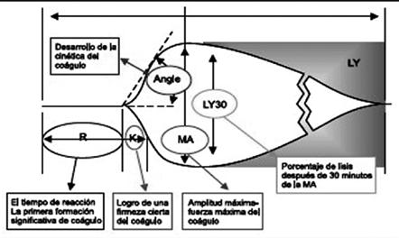 Rev. card. 2016;3(1): 25-30 L.M. Bardales-Ruiz, J. Rocha-Puente et al. grande que tiene el coágulo y es una función de la elasticidad del coágulo.