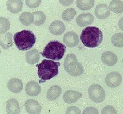 Linfocitos Los linfocitos T y B son los responsables de la respuesta inmune Se producen en los órganos linfoides