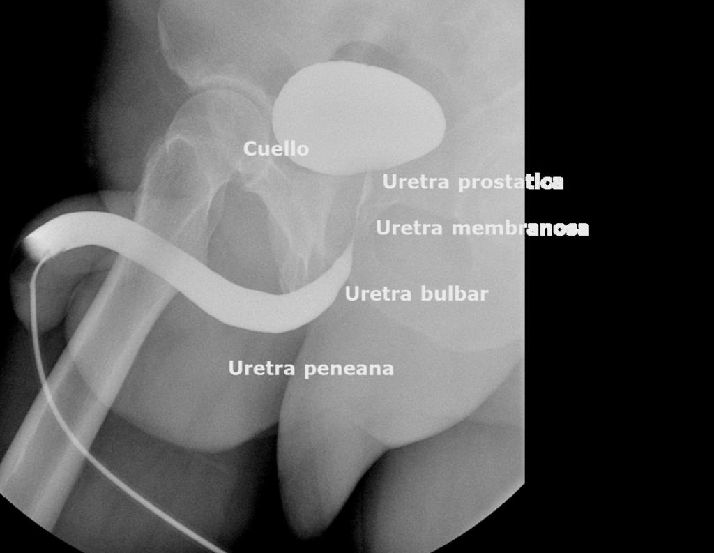 Fig. 9: Anatomía uretra